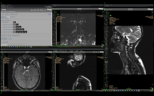 Hyland NilRead WinMan screenshot